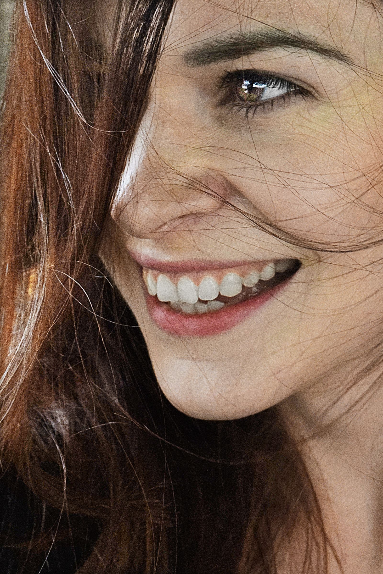 After: Coffee stain whitening