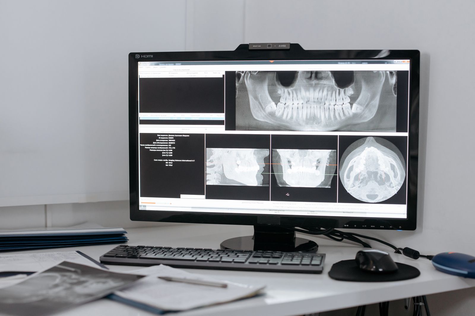 Digital dental x-ray on a monitor